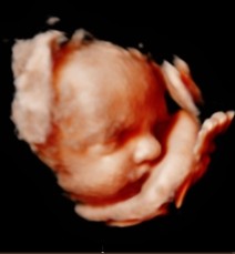30 week 3D ultrasound