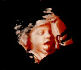 35 week 3D ultrasound