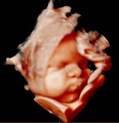 34 week 3D ultrasound